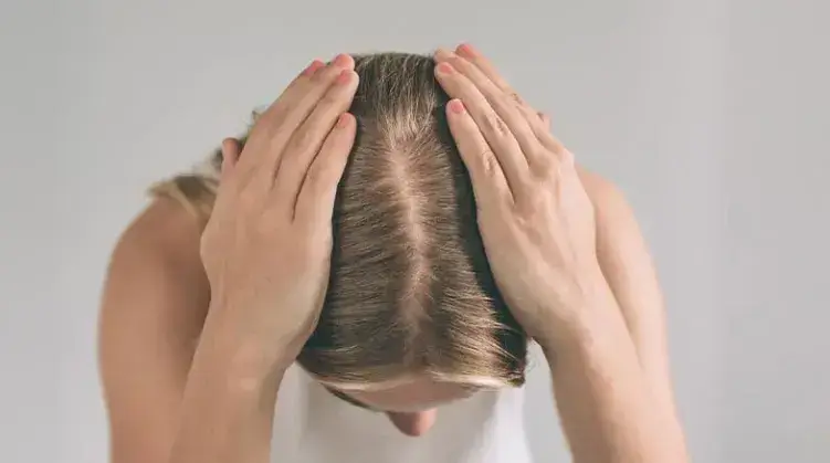 What is Female Hair Transplantation?